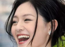 女明星的牙齿